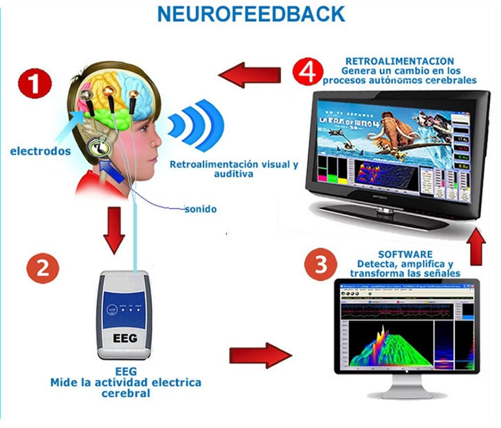 Proceso Neurofeedback